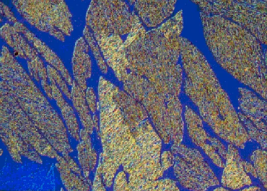 431 stainless steel microstructure at 400X magnification